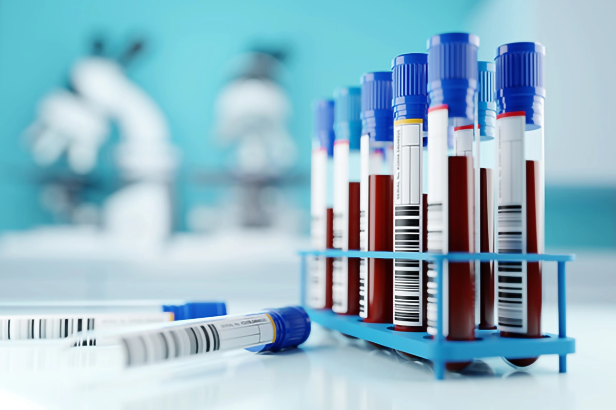 blood-results